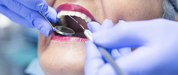 Best Emergency Broken Tooth Repair in Yuma, CO